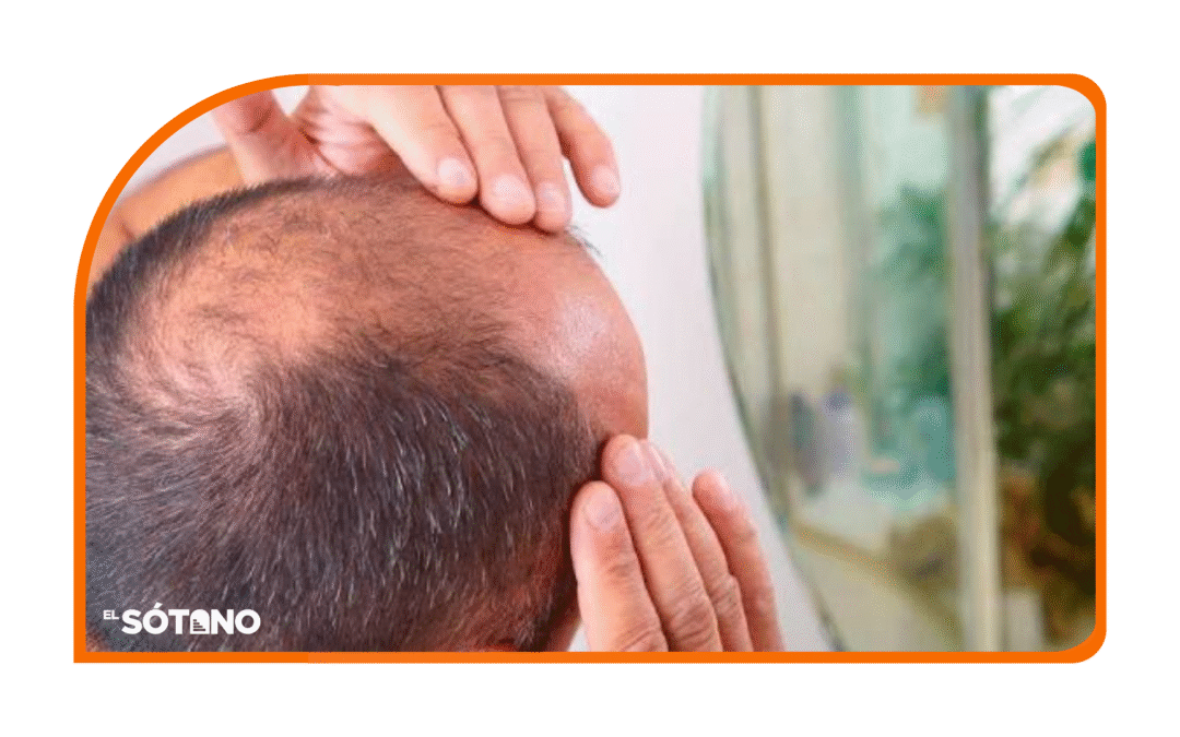 LA CALVICIE HOY: ENTRE LA ACEPTACIÓN, LA CIENCIA Y LAS NUEVAS SOLUCIONES